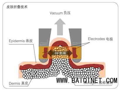 工作原理示意圖-丹意達(dá)M6減肥設(shè)備